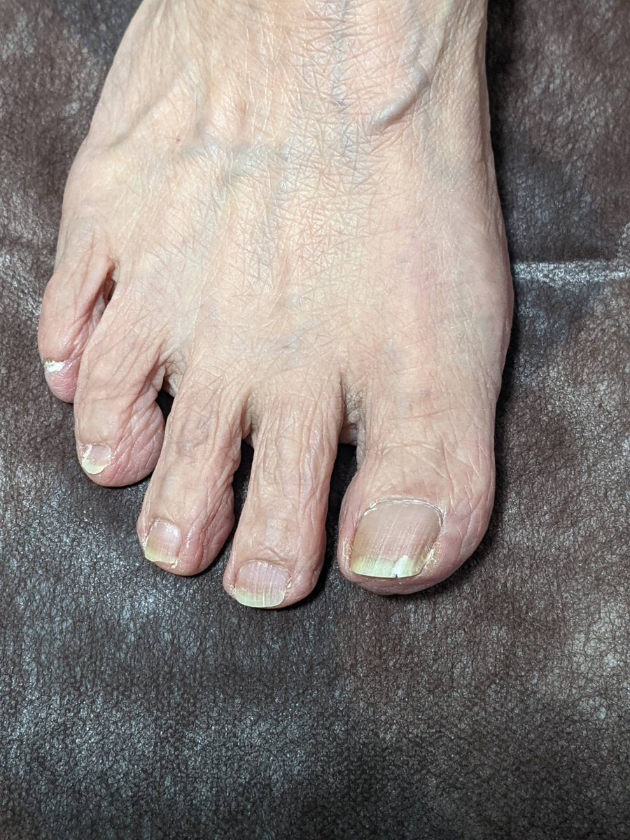 祖母とわたしとケアビューティー